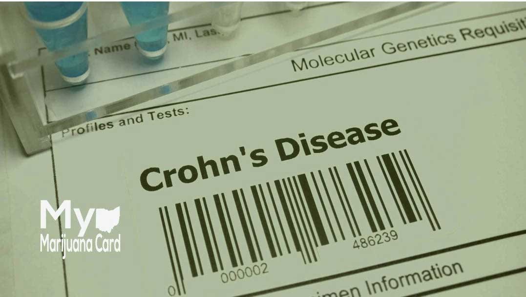 Medical Marijuana As A Treatment Plan For Crohn’s Disease